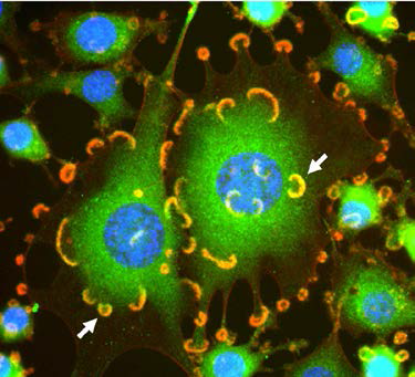 Src-transformed NIH3T3 cells showing co-localization (yellow/orange) of Tks5 (green) and F-actin (red) at invadosomes (arrows); nuclei (blue).